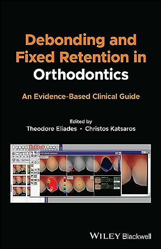 Debonding and Fixed Retention in Orthodontics: An Evidence-based Clinical Guide von Blackwell Pub