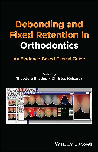 Debonding and Fixed Retention in Orthodontics: An Evidence-based Clinical Guide