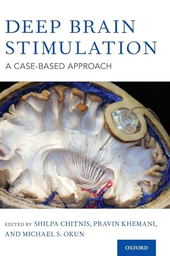 Deep Brain Stimulation: A Case-Based Approach von OUP USA