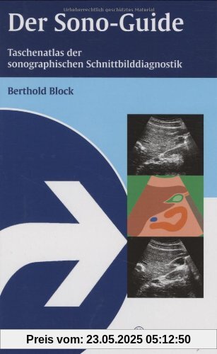 Der Sono-Guide: Taschenatlas der sonographischen Schnittbilddiagnostik