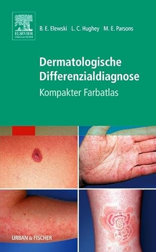 Dermatologische Differenzialdiagnose: Kompakter Farbatlas