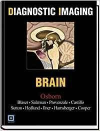 Diagnostic Imaging - Brain: Top 250 Diagnostic Diagnostic Imaging - Brain: Top 250 Diagnostic