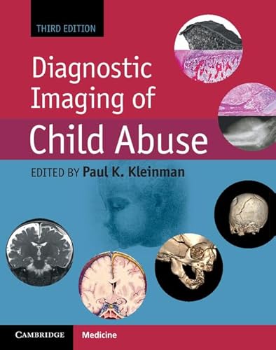 Diagnostic Imaging of Child Abuse von Cambridge University Press