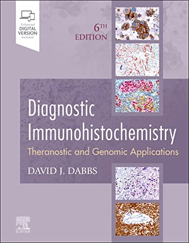 Diagnostic Immunohistochemistry: Theranostic and Genomic Applications von Elsevier