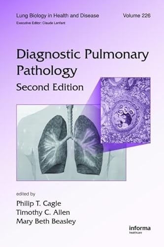 Diagnostic Pulmonary Pathology (Lung Biology in Health and Disease, 226, Band 226) von CRC Press