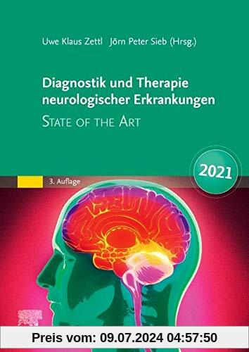 Diagnostik und Therapie neurologischer Erkrankungen: State of the Art 2021