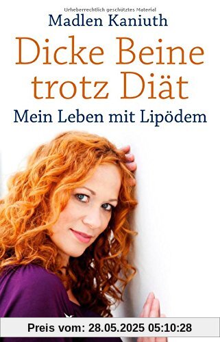 Dicke Beine trotz Diät: Mein Leben mit Lipödem