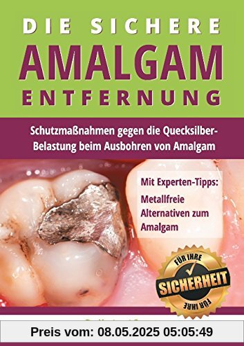 Die sichere Amalgam-Entfernung: Schutzmaßnahmen gegen die Quecksilber-Belastung beim Ausbohren von Amalgam Die sichere Amalgam-Entfernung: Schutzmaßnahmen gegen die Quecksilber-Belastung beim Ausbohren von Amalgam