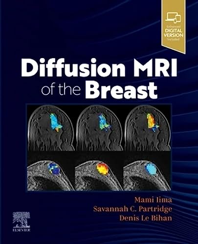 Diffusion MRI of the Breast von Elsevier