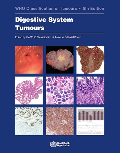 Digestive System Tumours: Who Classification of Tumours (World Health Organization Classification of Tumours, 1, Band 1) von World Health Organization