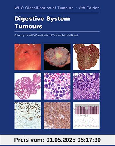 Digestive System Tumours: Who Classification of Tumours (World Health Organization Classification of Tumours, Band 1)