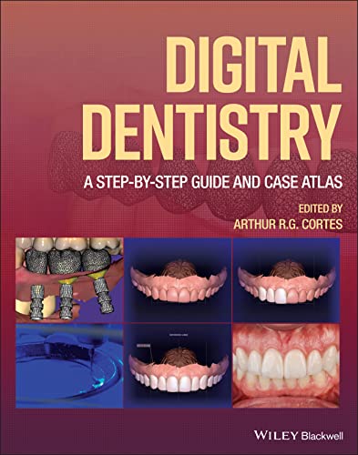 Digital Dentistry: A Step-by-Step Guide and Case Atlas