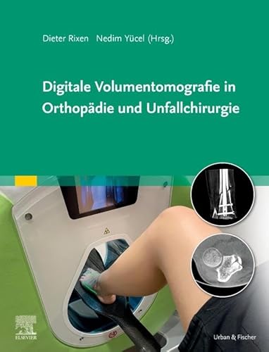 Digitale Volumentomografie in Orthopädie und Unfallchirurgie