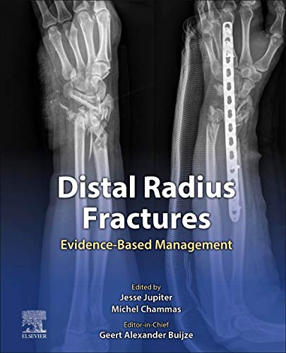 Distal Radius Fractures: Evidence-Based Management
