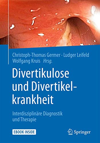 Divertikulose und Divertikelkrankheit: Interdisziplinäre Diagnostik und Therapie