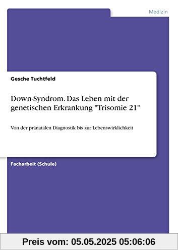 Down-Syndrom. Das Leben mit der genetischen Erkrankung Trisomie 21: Von der pränatalen Diagnostik bis zur Lebenswirklichkeit Down-Syndrom. Das Leben mit der genetischen Erkrankung Trisomie 21: Von der pränatalen Diagnostik bis zur Lebenswirklichkeit