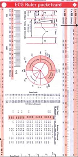 ECG Ruler Pocketcard ECG Ruler Pocketcard
