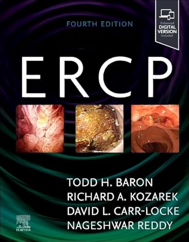 ERCP von Elsevier