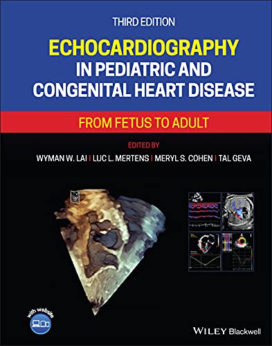 Echocardiography in Pediatric and Congenital Heart Disease: From Fetus to Adult von Wiley-Blackwell