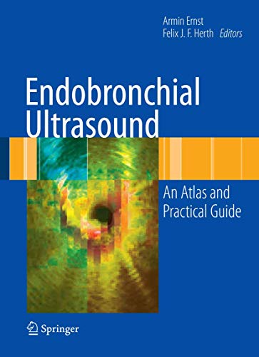 Endobronchial Ultrasound: An Atlas and Practical Guide von Springer