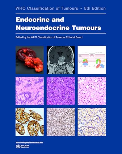 Endocrine and Neuroendocrine Tumours: Who Classification of Tumours von IARC