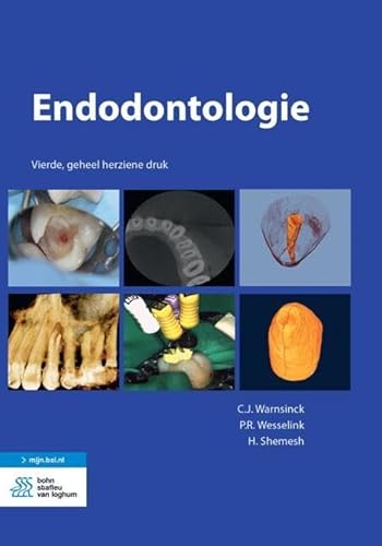 Endodontologie von Bohn Stafleu van Loghum