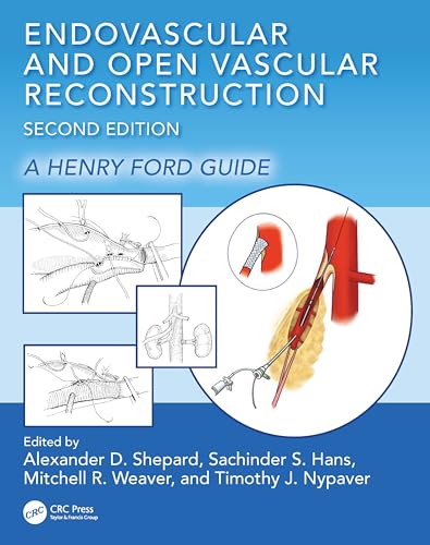 Endovascular and Open Vascular Reconstruction: A Henry Ford Surgical Guide Endovascular and Open Vascular Reconstruction: A Henry Ford Surgical Guide von CRC Press