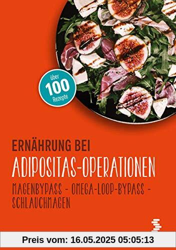 Ernährung bei Adipositas-Operationen: Magenbypass – Omega-Loop-Bypass - Schlauchmagen (maudrich.gesund essen)