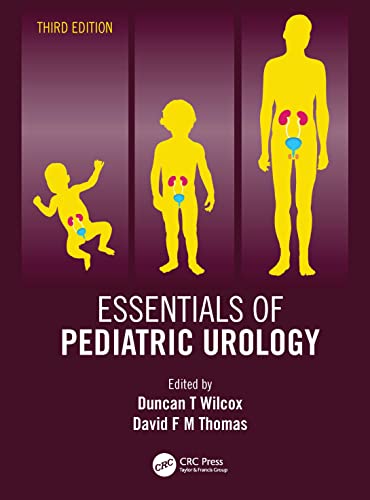 Essentials of Pediatric Urology von CRC Press