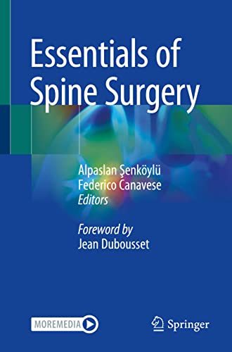 Essentials of Spine Surgery von Springer