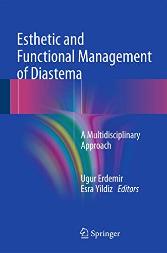 Esthetic and Functional Management of Diastema: A Multidisciplinary Approach Esthetic and Functional Management of Diastema: A Multidisciplinary Approach von Springer