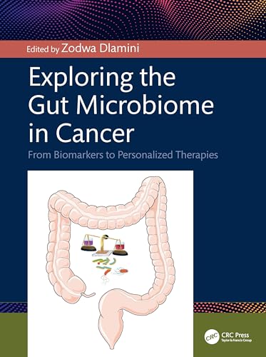 Exploring the Gut Microbiome in Cancer: From Biomarkers to Personalized Therapies Exploring the Gut Microbiome in Cancer: From Biomarkers to Personalized Therapies von CRC Press