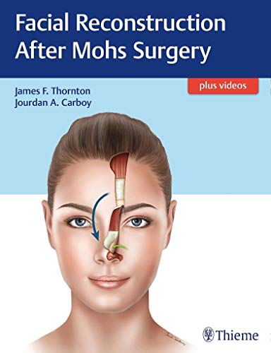 Facial Reconstruction After Mohs Surgery: Plus Videos