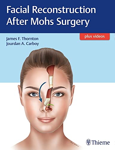 Facial Reconstruction After Mohs Surgery: Plus Videos von Thieme