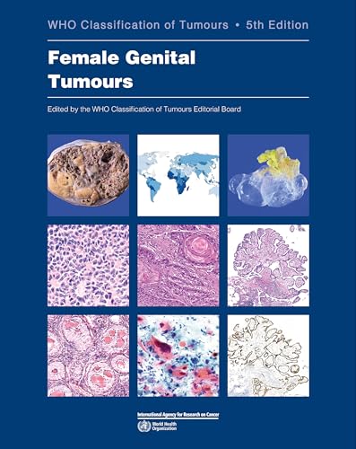 Female Genital Tumours: Who Classification of Tumours (Who Classification of Tumours, 4, Band 4)
