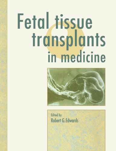 Fetal Tissue Transplants in Medicine Fetal Tissue Transplants in Medicine von Cambridge University Press