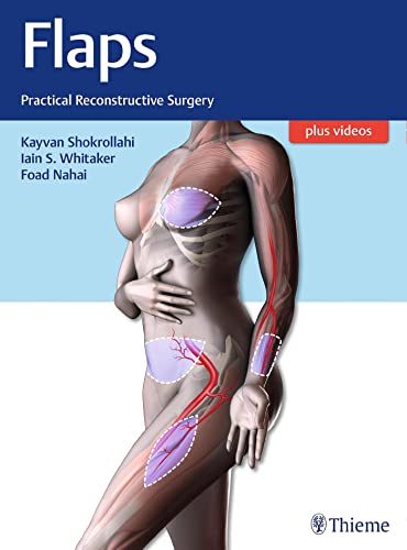 Flaps: Practical Reconstructive Surgery von Georg Thieme Verlag