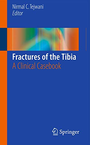 Fractures of the Tibia: A Clinical Casebook von Springer