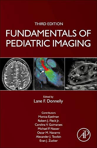 Fundamentals of Pediatric Imaging von Academic Press