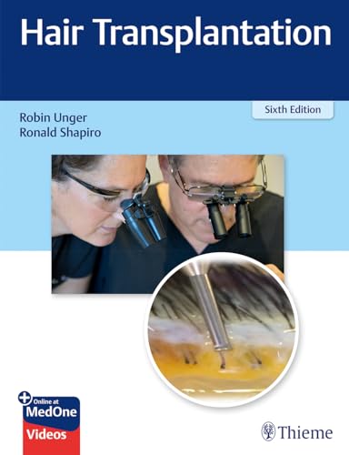 Hair Transplantation