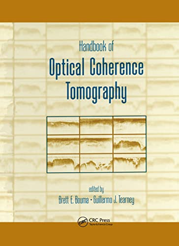 Handbook of Optical Coherence Tomography von CRC Press