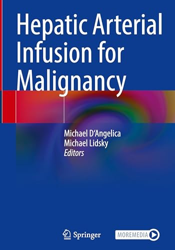 Hepatic Arterial Infusion for Malignancy von Springer