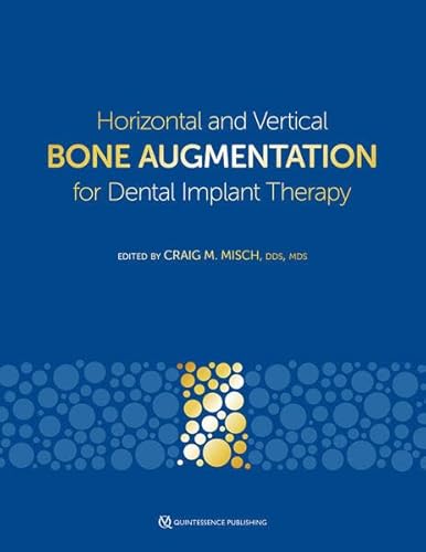 Horizontal and Vertical Bone Augmentation for Dental Implant Therapy von Quintessence Publishing