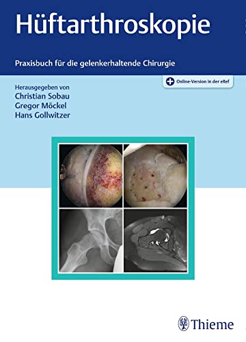 Hüftarthroskopie: Praxisbuch für die gelenkerhaltende Chirurgie von Georg Thieme Verlag