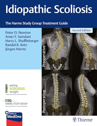 Idiopathic Scoliosis: The Harms Study Group Treatment Guide von Thieme Medical Publishers