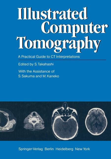 Illustrated Computer Tomography von Springer Berlin Heidelberg