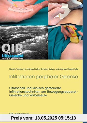Infiltrationen peripherer Gelenke: Ultraschall und klinisch gesteuerte Infiltrationstechniken am Bewegungsapparat - Gelenke und Wirbelsäule Infiltrationen peripherer Gelenke: Ultraschall und klinisch gesteuerte Infiltrationstechniken am Bewegungsapparat - Gelenke und Wirbelsäule