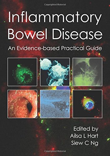 Inflammatory Bowel Disease: An Evidence-Based Practical Guide von TFM Publishing Ltd