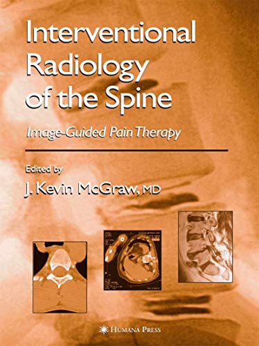 Interventional Radiology of the Spine: Image-Guided Pain Therapy von Humana