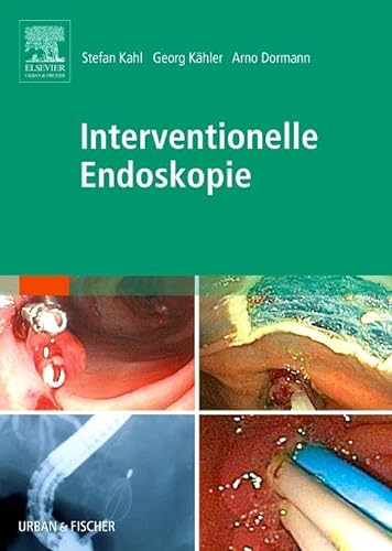 Interventionelle Endoskopie: Lehrbuch und Atlas von Elsevier